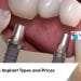 Megagen Dental Implants