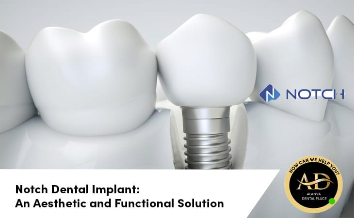 Notch Dental Implant: An Aesthetic and Functional Solution