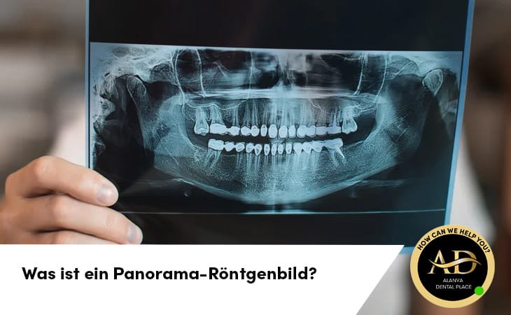 Was ist ein Panorama-Röntgenbild?