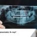 Panoramic X-ray