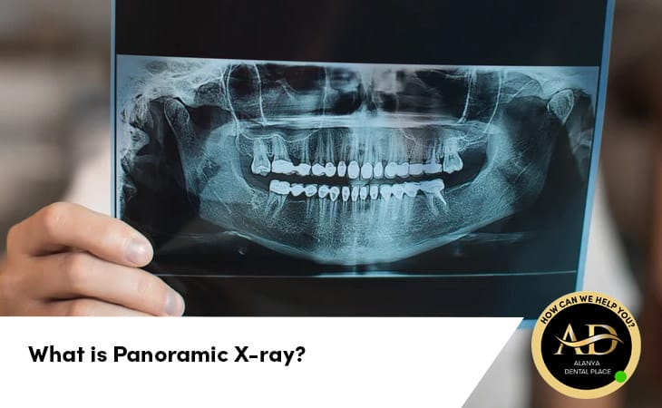 What is Panoramic X-ray?