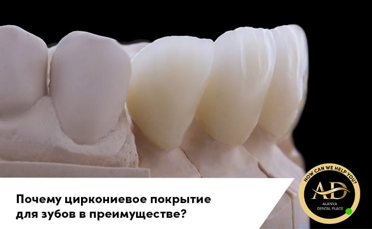 Почему циркониевое покрытие для зубов в преимуществе?