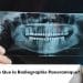 Radiographie Panoramique