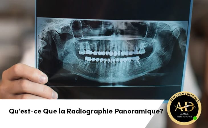 Qu’est-ce Que la Radiographie Panoramique?
