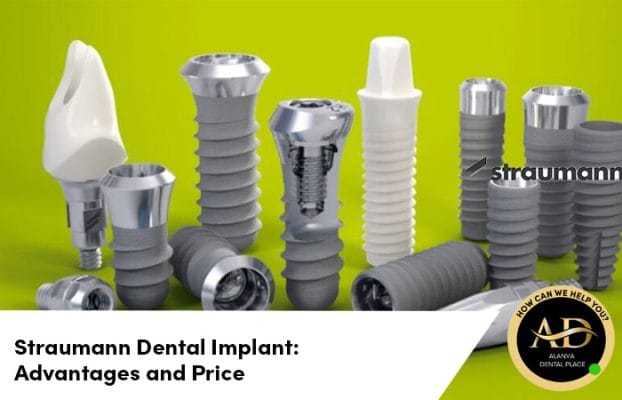 Straumann Dental Implant: Advantages and Price