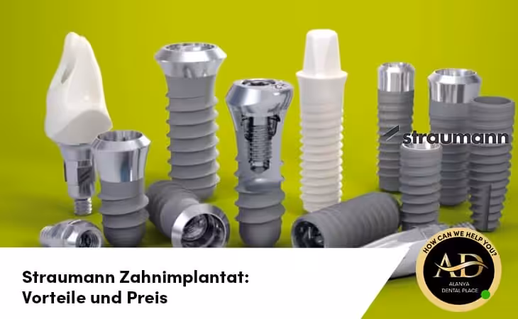 Straumann Zahnimplantat: Vorteile und Preis