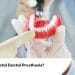 What is Total Dental Prosthesis