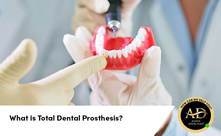 What is Total Dental Prosthesis?