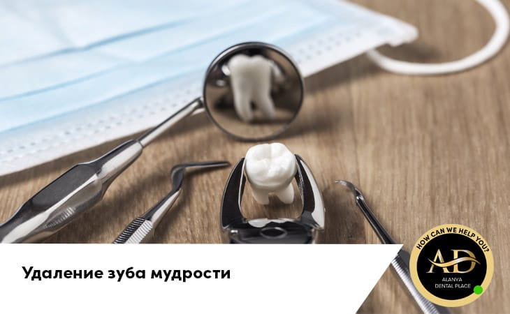 Удаление зуба мудрости