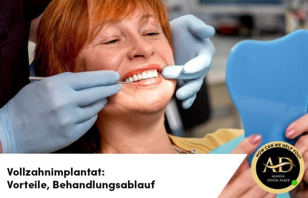 Vollzahnimplantat: Vorteile, Behandlungsablauf