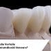 Was sind die Vorteile von Zirkoniumdioxid-Veneers