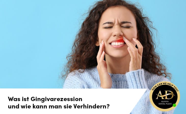 Was ist Gingivarezession und wie kann man sie Verhindern?