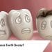 What Causes Tooth Decay?
