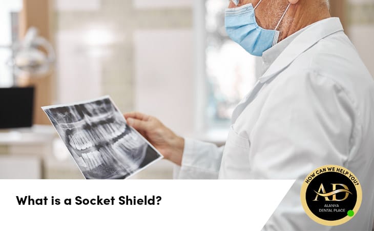 What is a Socket Shield?
