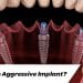 What-is-Aggressive-Implant