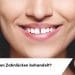 Wie werden Zahnlücken behandelt?