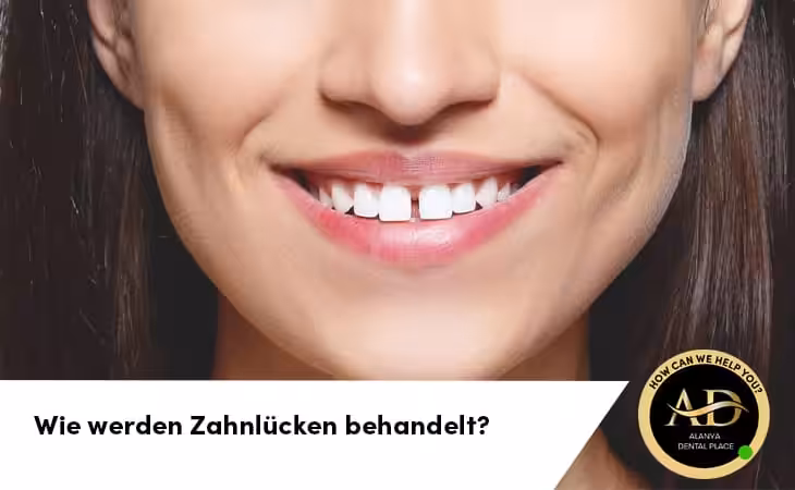 Wie werden Zahnlücken behandelt?