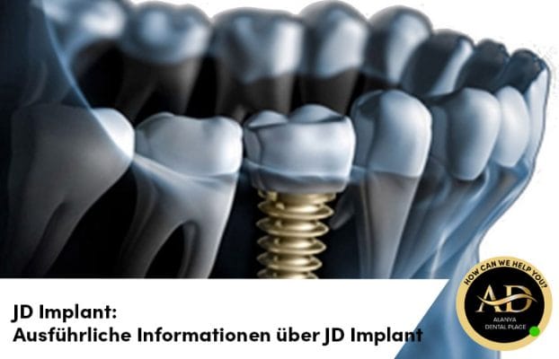 JD Implant: Ausführliche Informationen über JD Implant