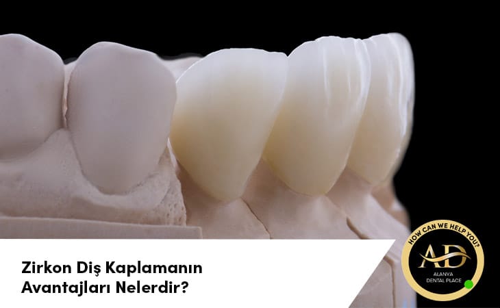 Zirkon Diş Kaplamanın Avantajları Nelerdir?