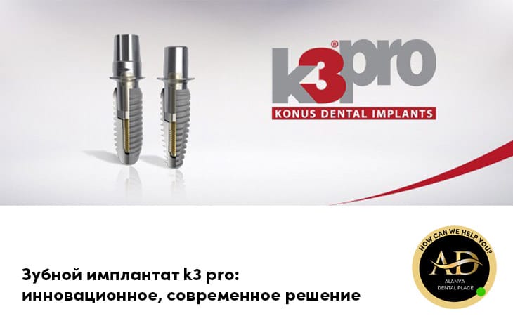 Zubnoy implantat k3 pro