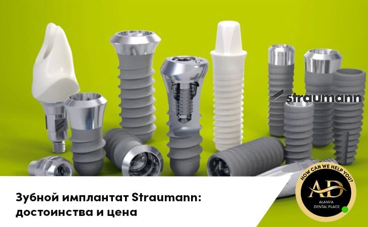 Зубной имплантат Straumann: достоинства и цена