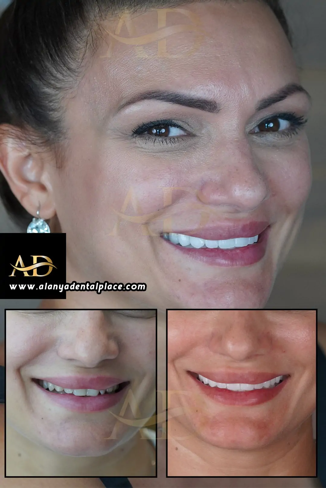 Before After