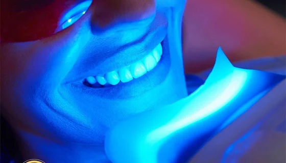 Blanchiment Des Dents