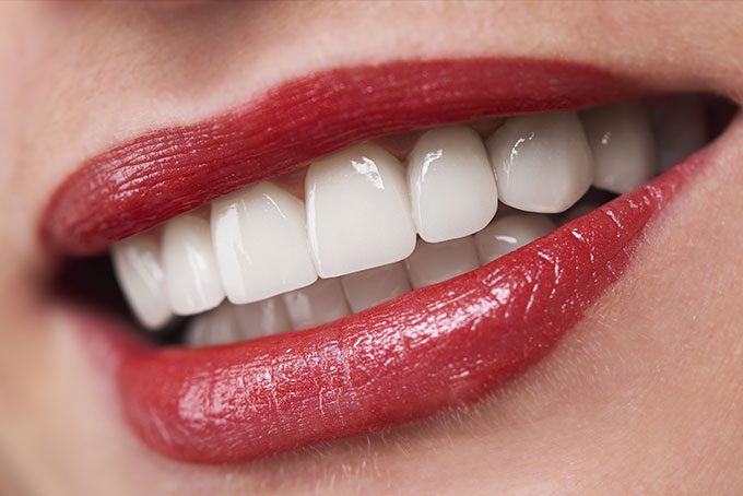 Голливудская Улыбка