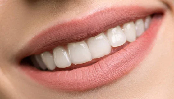 Laminated Dental in Antalya, Turkey