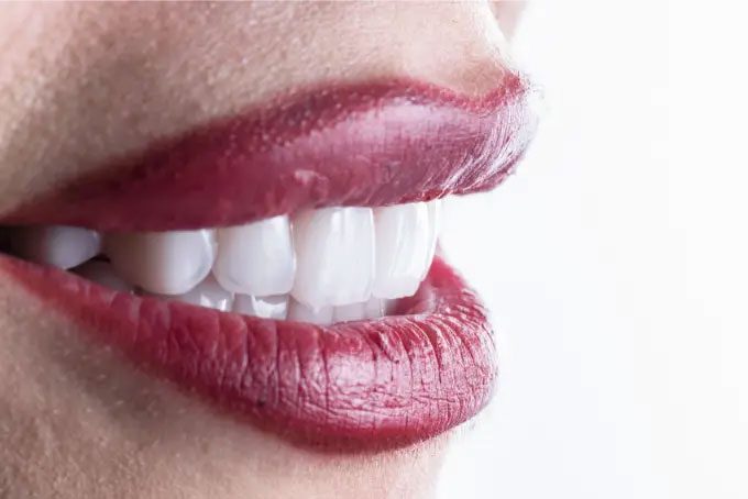 E.max это Цельнокерамические Коронки