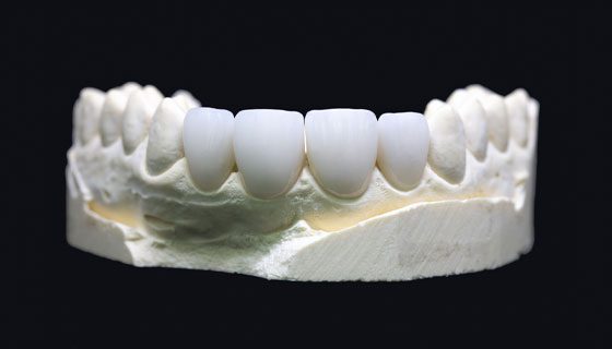 Zirconium Crown in Turkey