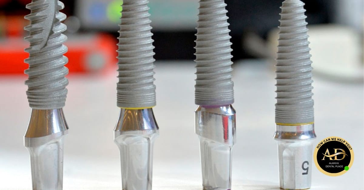 Was sind die Durchschnittlichen Preise für Zahnimplantate? 2 Image link