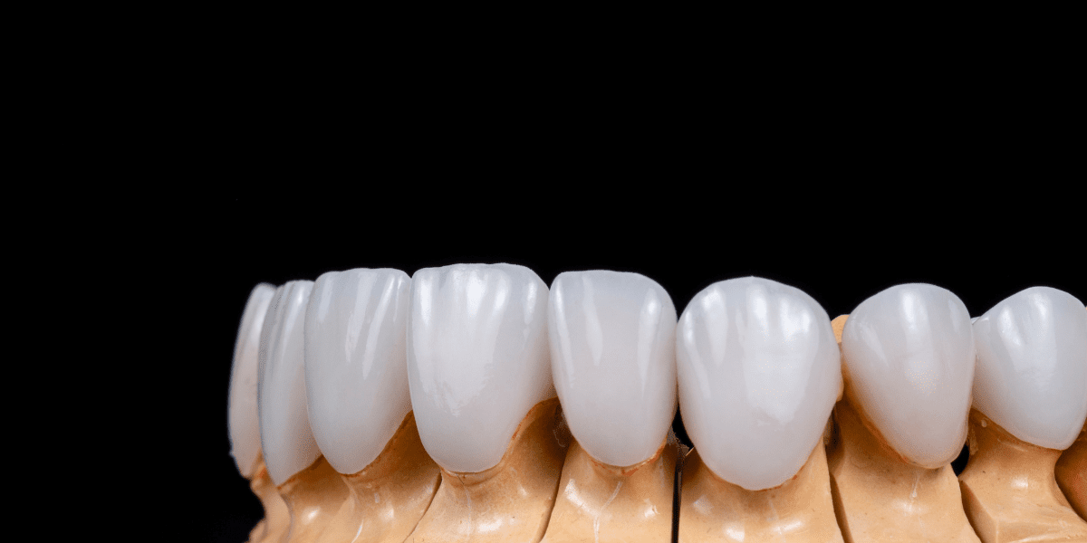 Laminated Dental 4 Image link