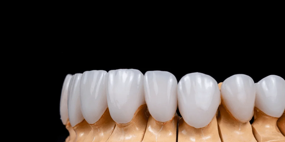 Ламинированная Стоматология 4 Image link