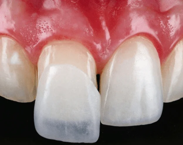 Ламинированная Стоматология 2 Image link