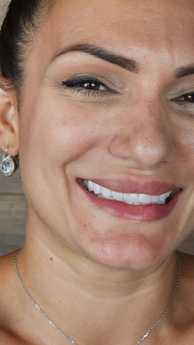 Зубной имплантат Landing 7 Image