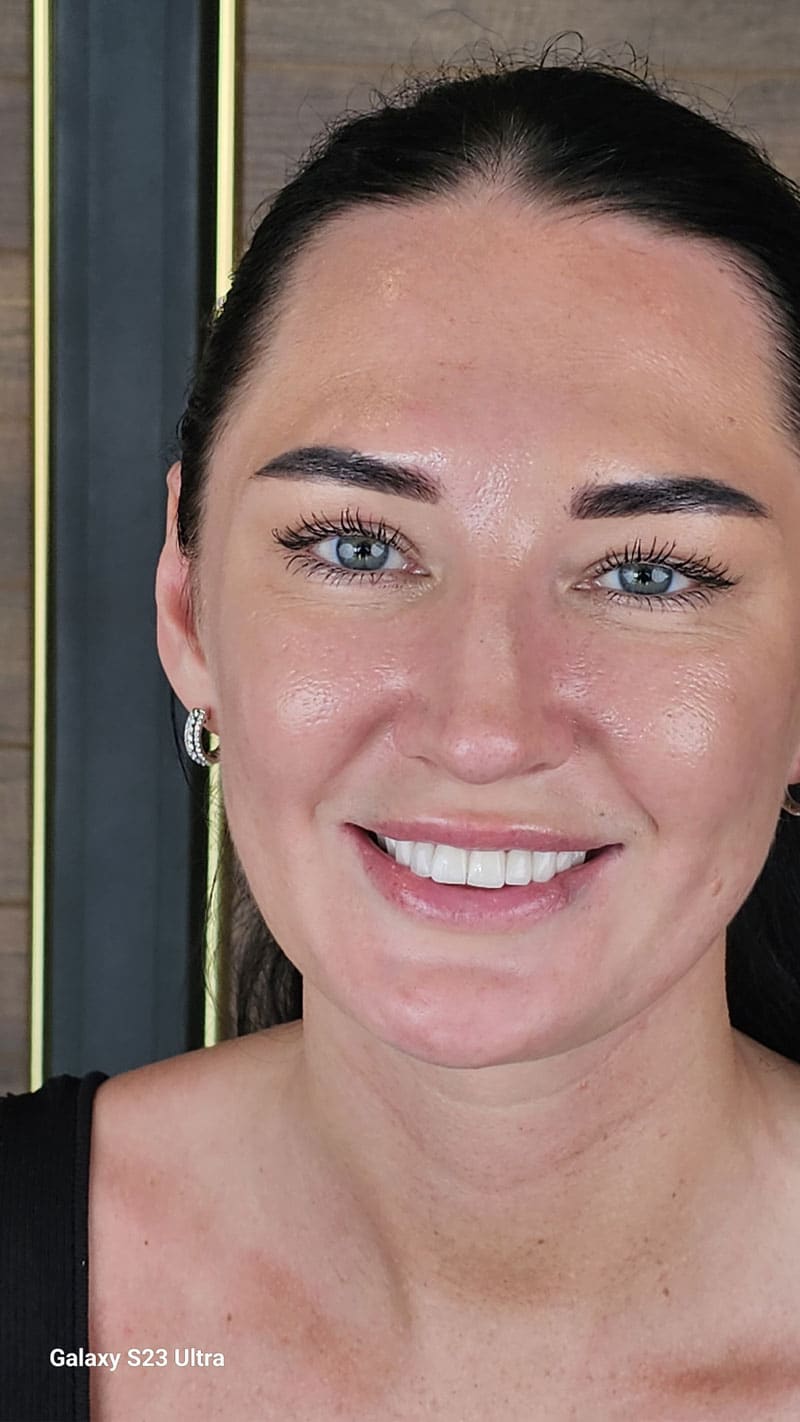 Зубной имплантат Landing 8 Image