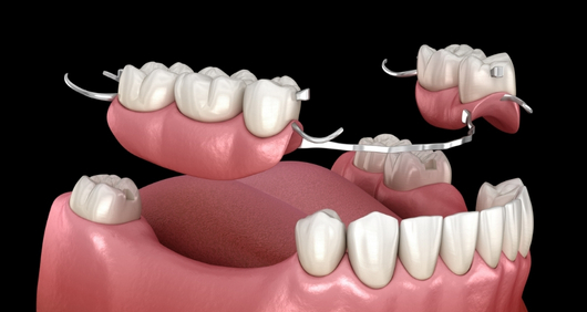 Removable Dental Prosthesis Turkey