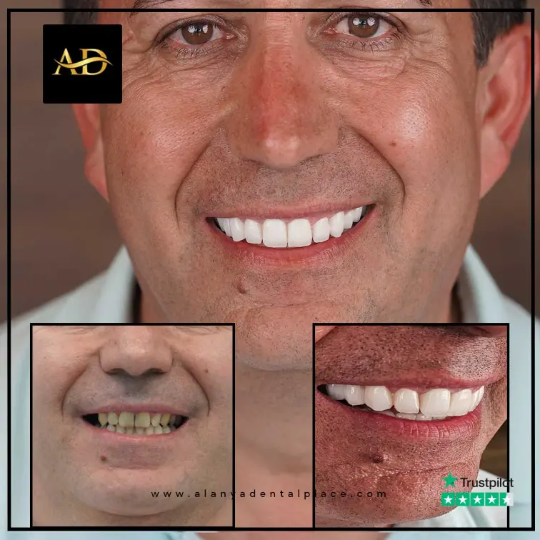 5-2-3.webp