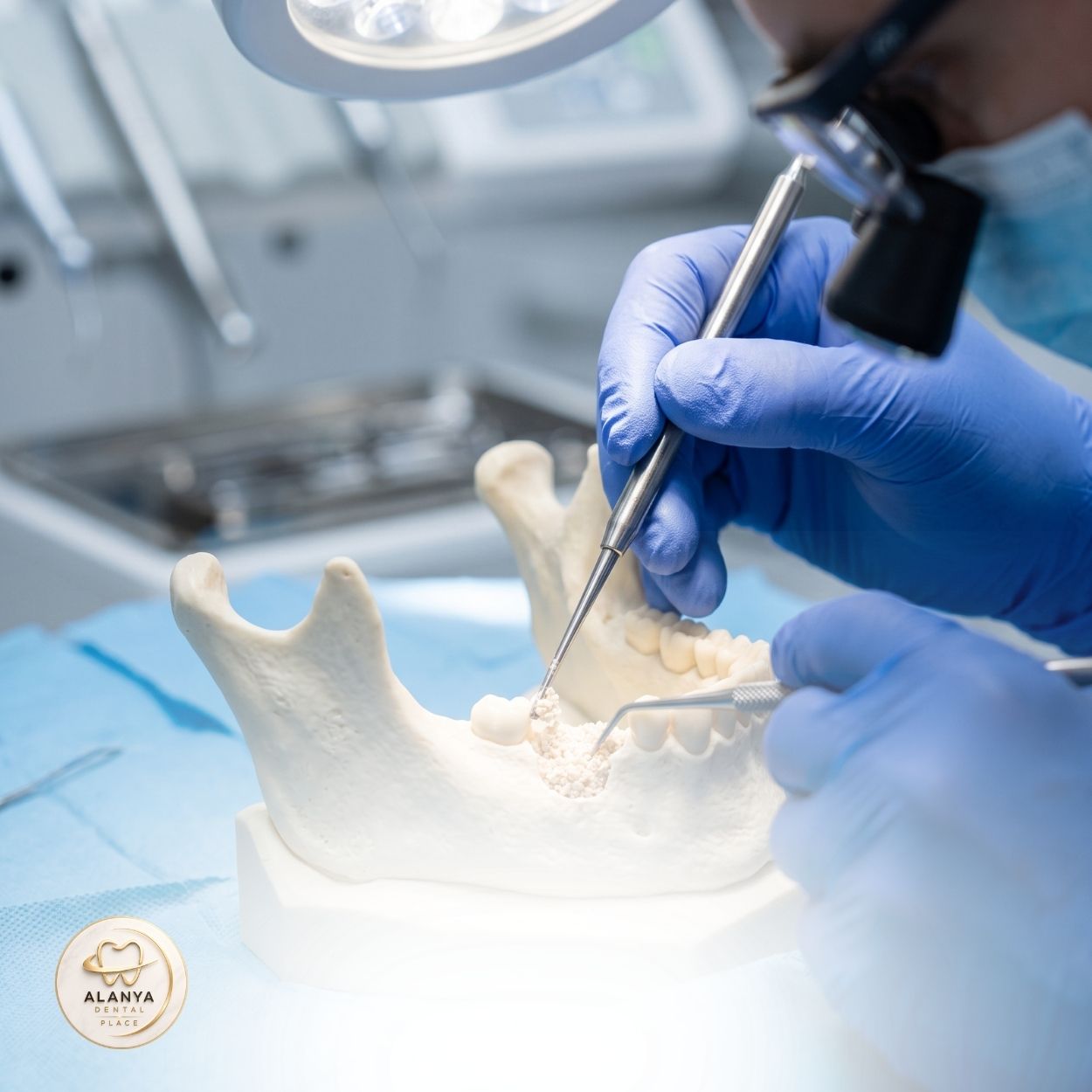Bone Graft Surgery 5 Bone Graft Surgery in Turkey 4