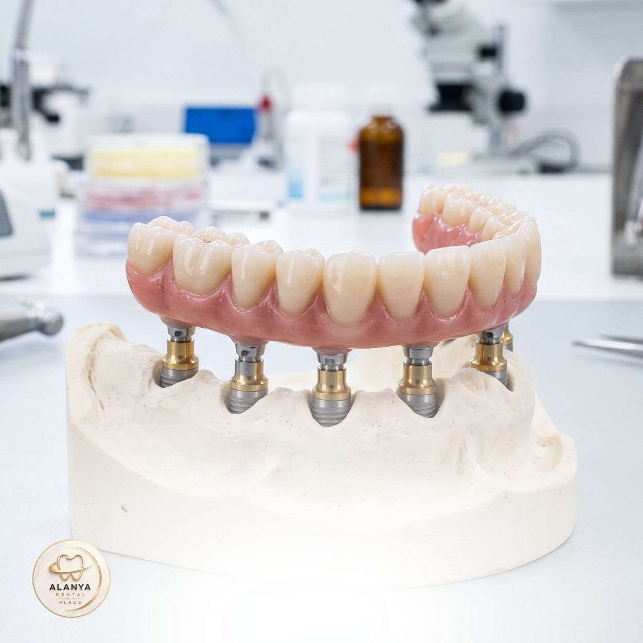 Full Mouth Dental Implants 11 Full Mouth Dental Implants