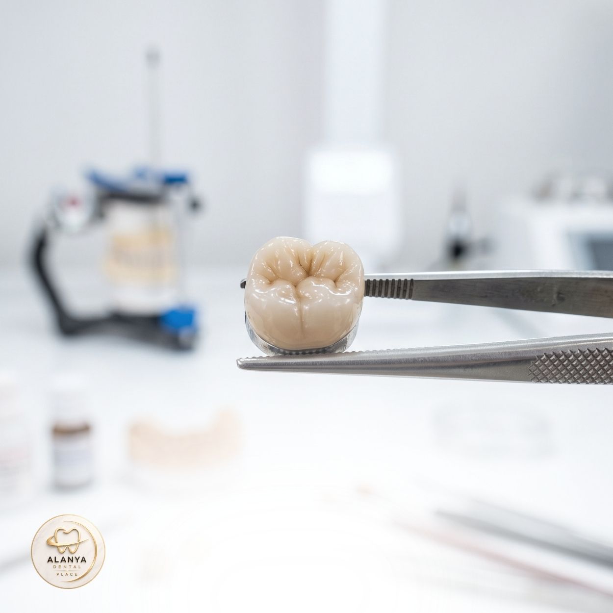 Metal-Supported Porcelain Crowns 6 Gold Alloy Reinforced Porcelain 2