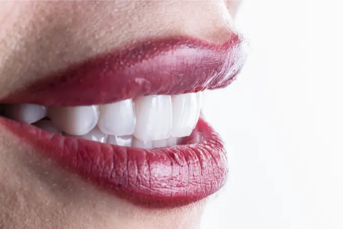 Korony dentystyczne Emax