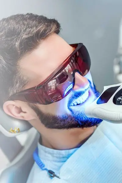 Отбеливание зубов (Bleaching)