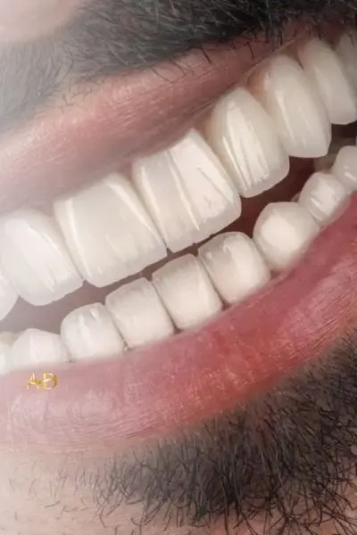Revêtement en zirconium
