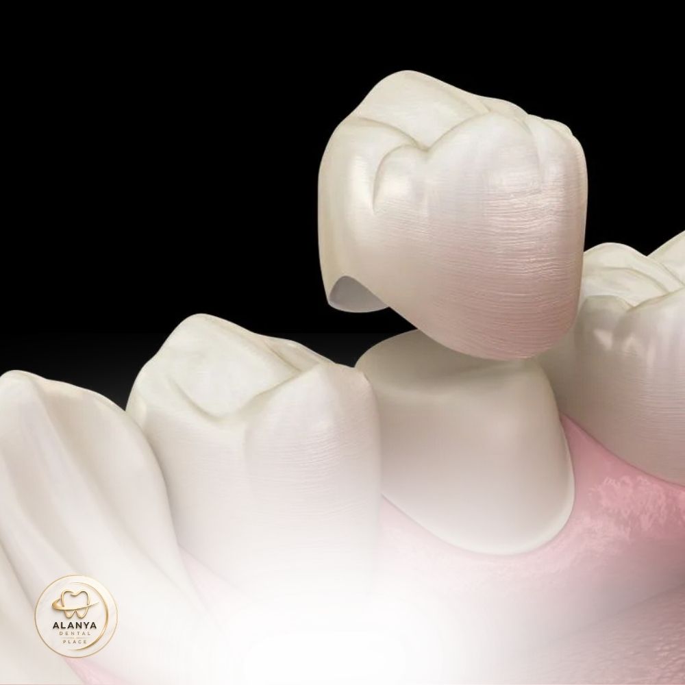 Image link
