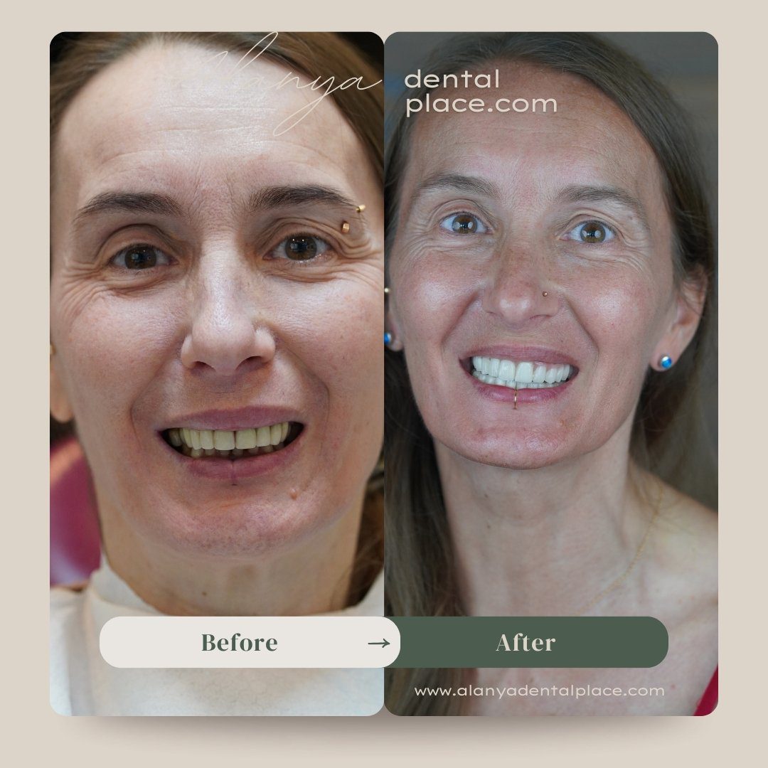 before 5 3 jpg