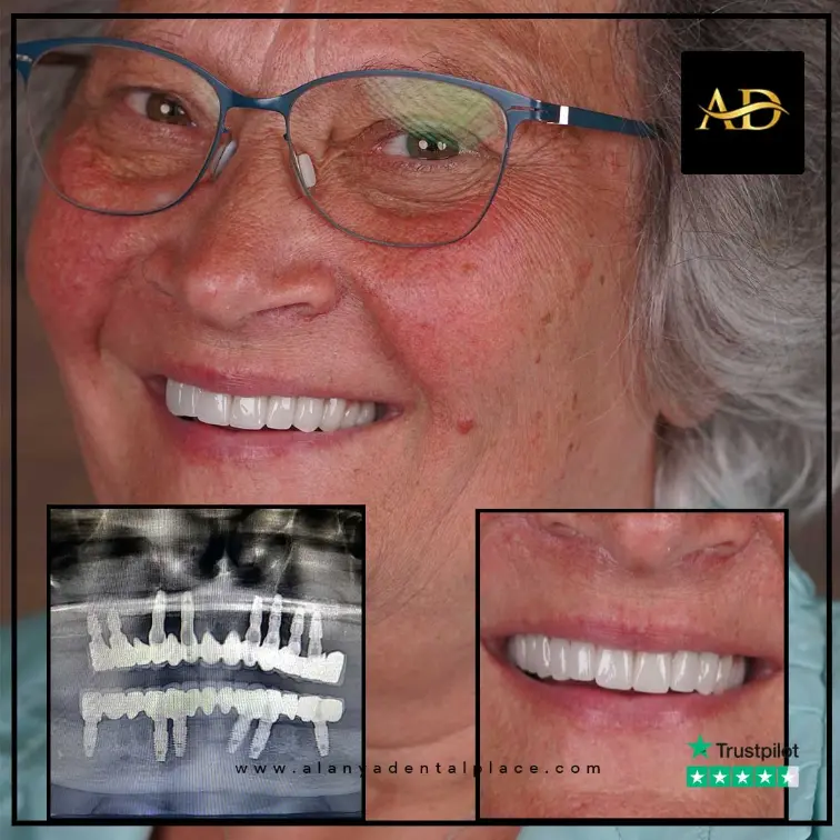 before-after-1-2.webp